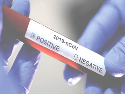 Covid-19 is not a black swan but rather a predictable uncertainty