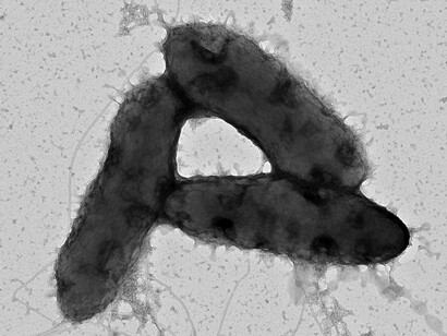 Três células da bactéria Pseudomonas registradas por microscopia eletrônica. Estudos sobre esses microrganismos ampliam o conhecimento sobre sua interação com as plantas e favorecem o desenvolvimento de bioinsumos mais eficientes e seguros