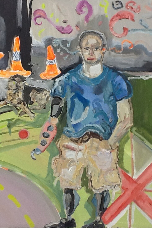 Sheila Rennick, War Legs