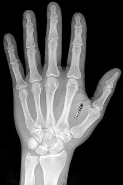 Con estas neuroarmas se logrará hacer pensar y/o sentir lo que determinados centros de poder quieren que se piense o se sienta