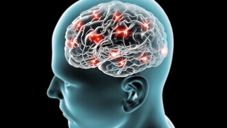 Actividad cerebral