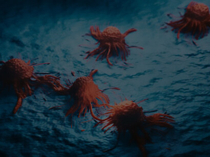 Proliferating cancer cells