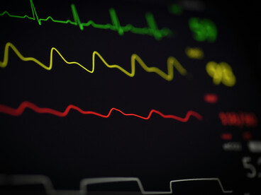 Sudden cardiac arrest (SCA) strikes without warning, often in people who show few or no prior symptoms