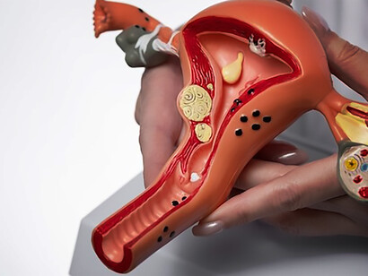 Female reproductive system model held by hand for educational purposes