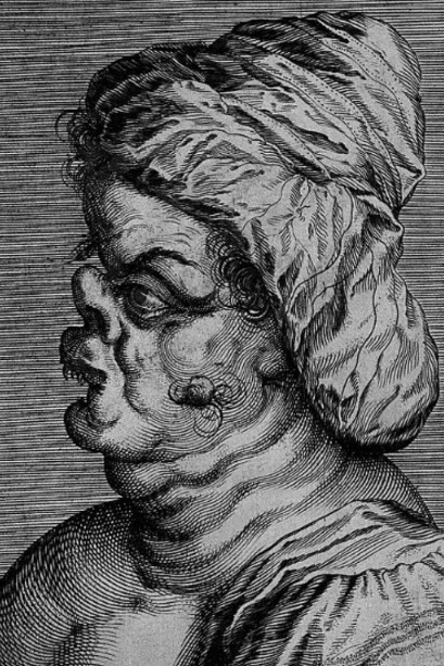 Frau von Brustaniana, a character with a grotesque face. Line engraving attributed to D. Custos