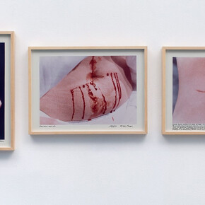 Gina Pane. Courtesy of Richard Saltoun Gallery