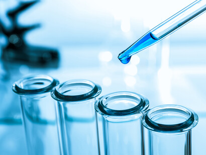 Analisi di laboratorio