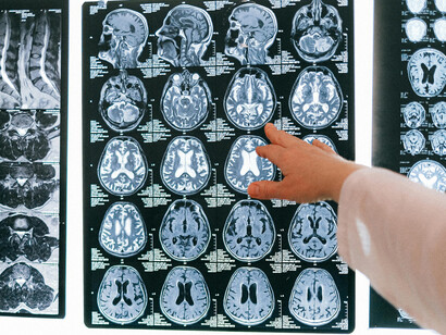 Close-up shot of MRI results