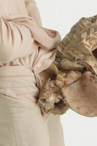 Aetiology Unknown 17, 2012 / 110 x 80 cm (43 5/16 x 31 ½ in. Ultrachrome print, photo janmanski.com