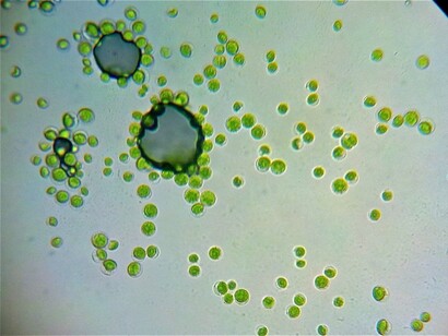 Organismos unicelulares al microscopio