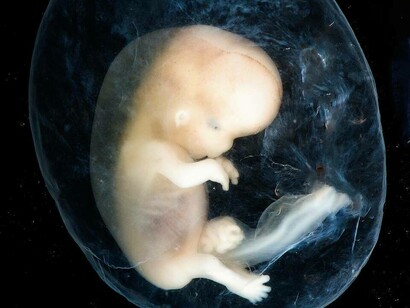 Embrione a circa 8-10 settimane dal concepimento