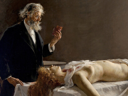 «La autopsia (¡Y tenía corazón!)» (1890), Enrique Simonet