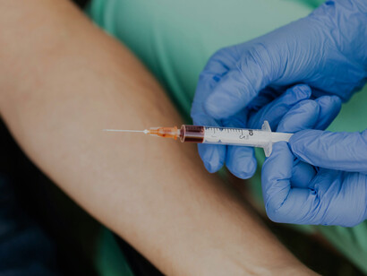 A diferencia de las biopsias tradicionales, la biopsia líquida analiza fluidos corporales como la sangre o la orina para identificar biomarcadores tumorales