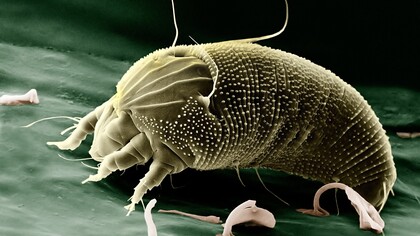 Dust mite enlarged under the microscope