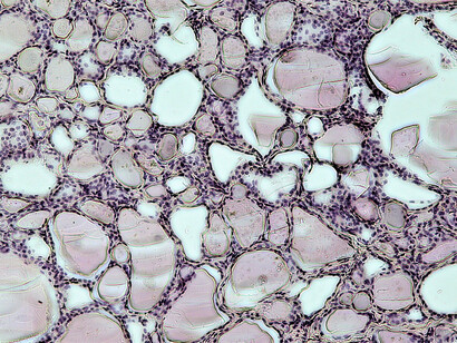 La glándula tiroidea tiene forma de mariposa y unos cinco centímetros de diámetro. Sección transversal, aumento: 100x, tinción con hematoxilina y eosina. Estructura folicular de la glándula tiroides humana