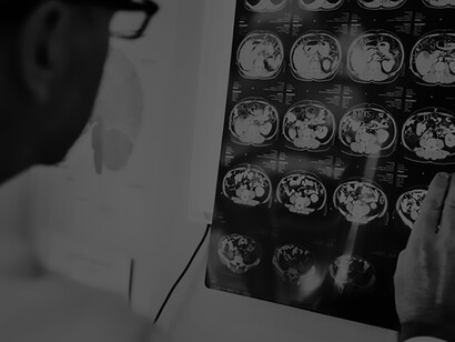 A physician reviewing a CT scan in conjunction with neuroimaging studies