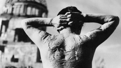 Víctima de la bomba atómica "Little Boy" lanzada sobre Hiroshima por Estados Unidos, el 6 de agosto de 1945