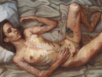 Ellie Kammer, Endometriosis (Deluge), 2018