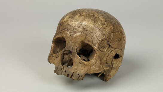 Scientific Instruments and the History of Medicine. Courtesy of GNM