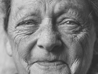 Years soaking up the sun have advanced and revealed the aging on this woman's face