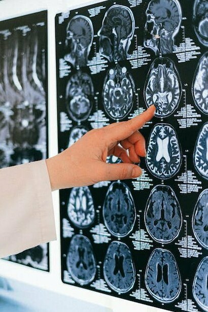 La neuroplasticità è una delle scoperte più emozionanti nella ricerca sul cervello, poiché dimostra che siamo in grado di cambiare e crescere, adattarci e riprogrammare forme di pensiero, movimenti e atteggiamenti
