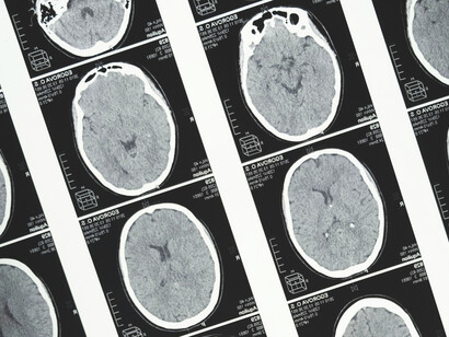 La tecnología no busca sustituir al profesional de la salud, sino ampliar su capacidad de análisis mediante una colaboración cada vez más estrecha entre la experiencia humana y los algoritmos inteligentes