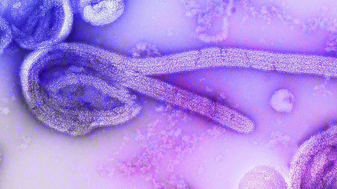 Virus del ébola