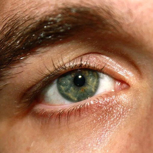 Acercamiento a un ojo humano con secciones heterocromas