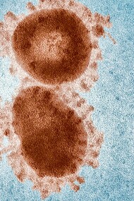 Les bactériophages sont des virus naturels très répandus dans l'environnement qui ciblent spécifiquement les bactéries