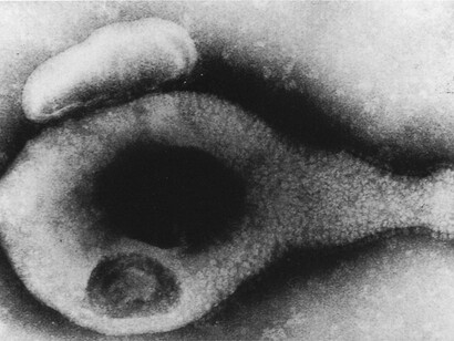 Mycoplasma genitalium