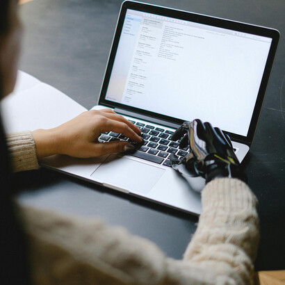 Using both a laptop and smartphone, a woman with a prosthetic hand demonstrates the empowering role of technology