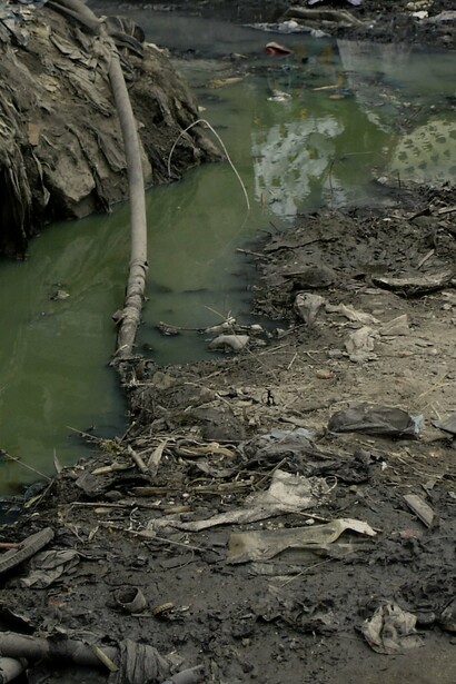 Pobre situación sanitaria en Tanzania