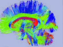 Mapas actuales de la conectividad anatómica del cerebro humano (panel A)