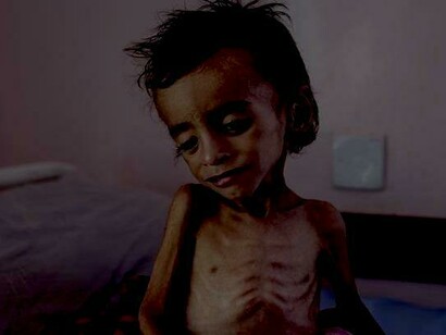 Los estragos de la guerra en Yemen