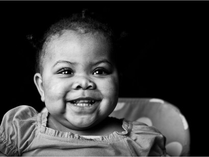 En los países subdesarrollados la tasa de supervivencia de los niños con cáncer no llega al 20%