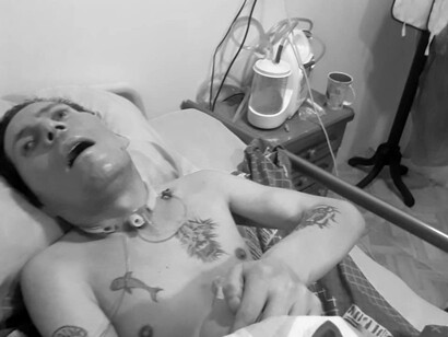 Mario está con tratamiento multidisciplinario, atendido por profesionales de la salud voluntarios, y mantenido gracias a donaciones, rifas, beneficios que hace su grupo de apoyo