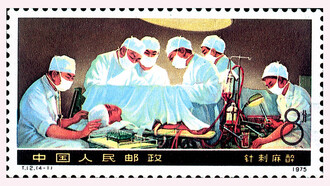 The 1975 Chinese postage stamp shows an open heart surgery under acupuncture anesthesia