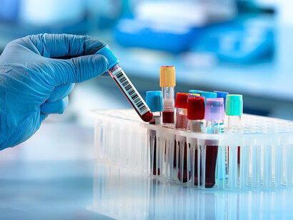 Esami genetici mostrano che i batteri resistenti hanno un gene chiamato mcr-1 che permette di evitare la tossicità della colistina