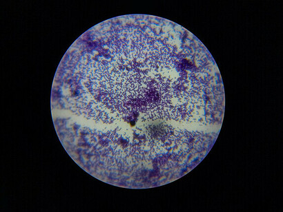 Tinción de Gram de Estreptococos. Identificar los tipos de bacterias presentes en la piel permite comprender por qué la higiene de manos es clave para prevenir enfermedades