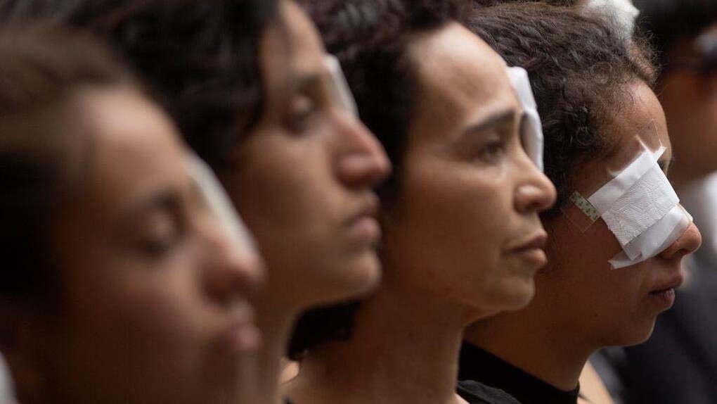 Young protesters show solidarity with those who lost an eye due to the brutal police repression in Chile