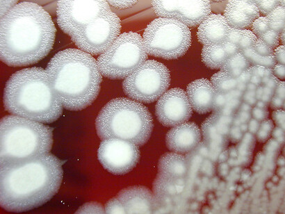 Cultivo de «Bacillus anthracis»