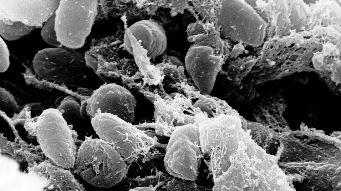 Questa immagine raffigura il batterio della peste visto al microscopio