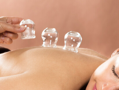 Cupping therapy