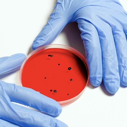 C’est à l’Institut Pasteur que sont mis en évidence, vers 1915-1917, une catégorie de virus qui infestent les bactéries