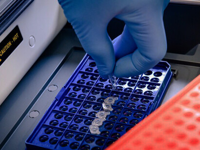 A dedicated laboratory professional arranges colorful pipette tips in a blue container to streamline genetic testing workflows