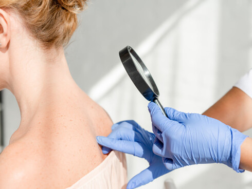 Esame dermatologico. Una delle limitazioni che pregiudicano in parte, l’impiego di sistemi di Intelligenza Artificiale sono gli errori di selezione nella scelta dei campioni su cui tali sistemi vengono istruiti