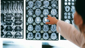 Una studiosa osserva le lastre di un cervello