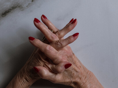 An older woman's hands clasped shows the aging of the skin