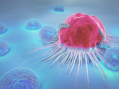 Vivid 3D illustration showcasing a cancer cell surrounded by lymphocytes for medical visualization