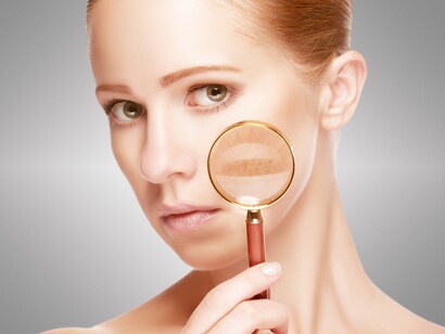 Detectando manchas en la piel